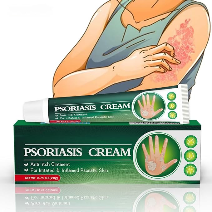Psoriasis Cream (Original) – 20g